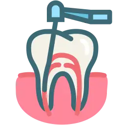 Root canal treatments